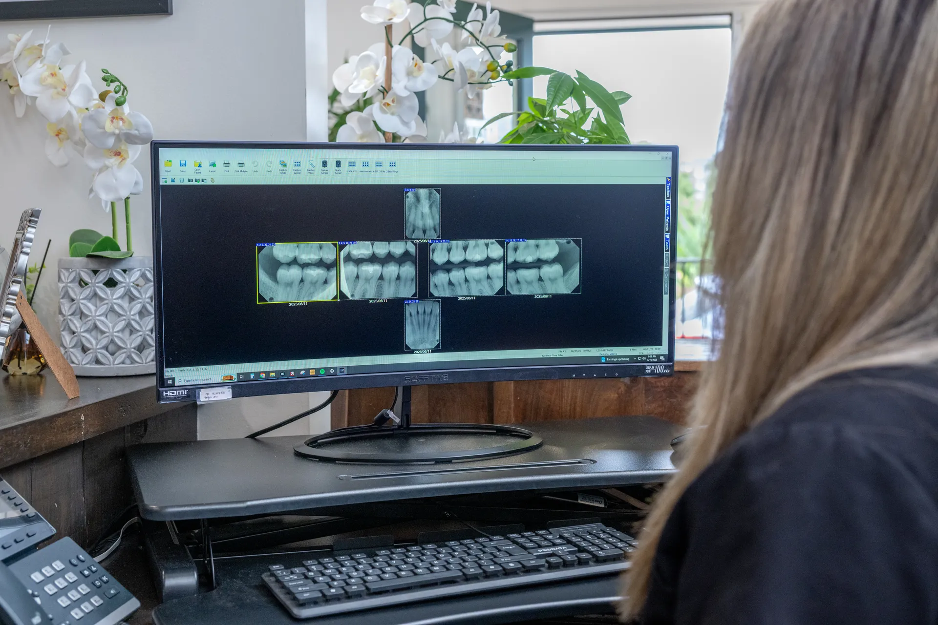 Team member reviewing digital dental X-rays on a widescreen monitor
