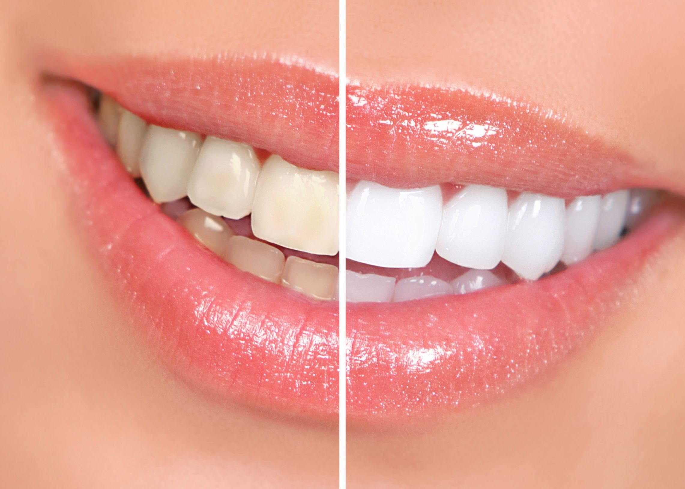 Cosmetic Dentistry