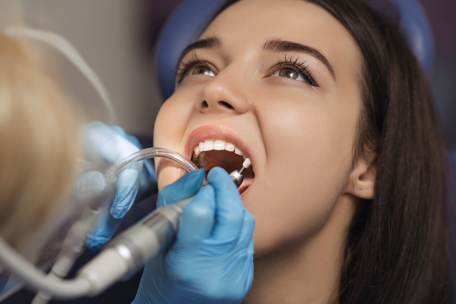 Dental Implants Aftercare: Essential Tips for a Smooth Recovery and Long-Term Success