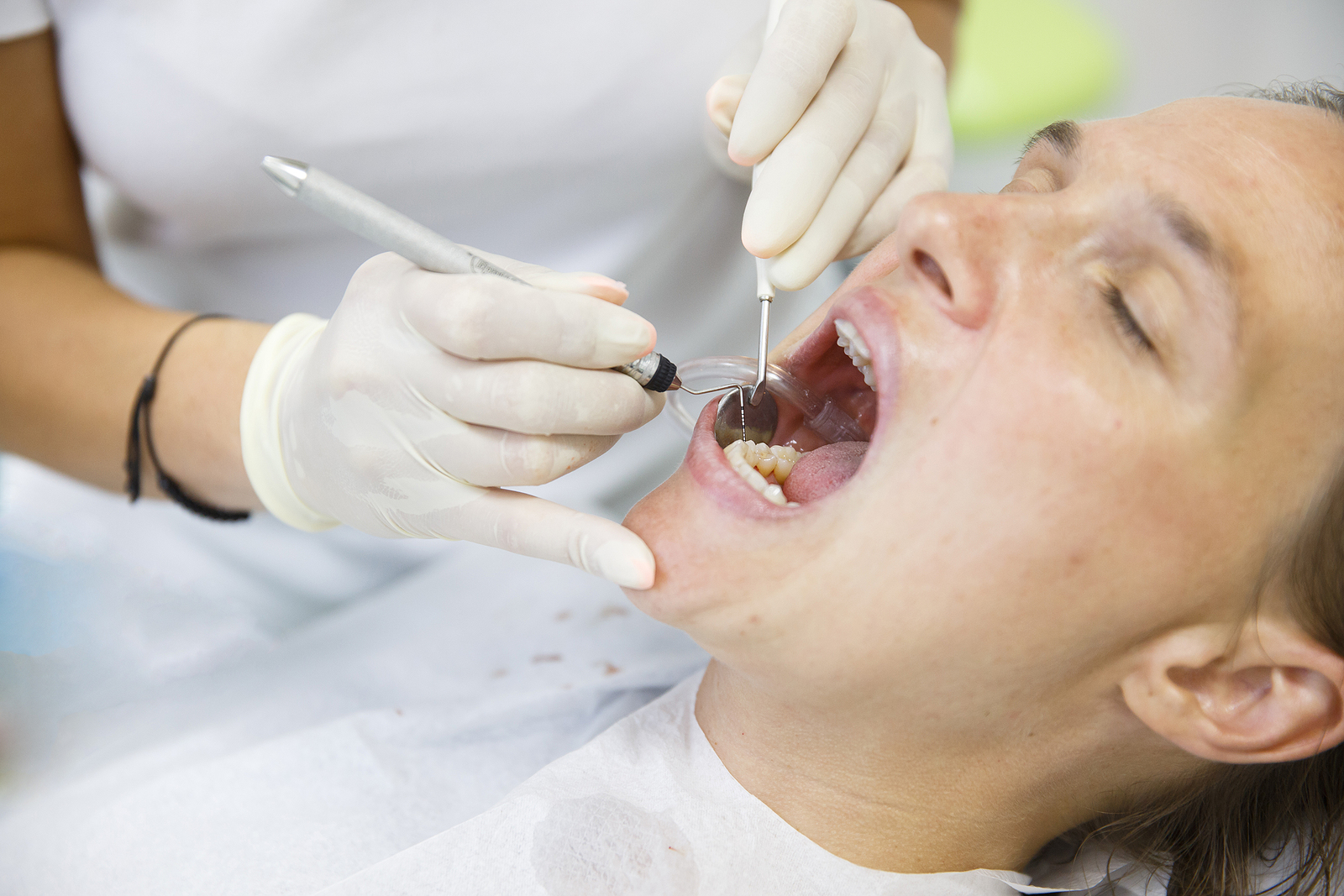What to Expect During Dental Implant Surgery: Pain, Recovery, and Healing